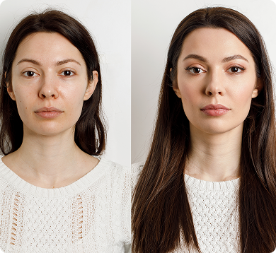before-after-4